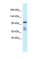 MICAL1 / MICAL Antibody - MICAL1 antibody Western blot of Placenta lysate. Antibody concentration 1 ug/ml.  This image was taken for the unconjugated form of this product. Other forms have not been tested.