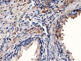 MICAL1 / MICAL Antibody - IHC of paraffin-embedded Human prostate tissue using anti-MICAL1 mouse monoclonal antibody.