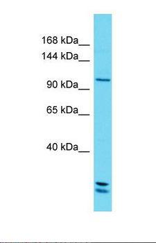 MICAL2 Antibody - Western blot of Human Jurkat. MICAL2 antibody dilution 1.0 ug/ml.  This image was taken for the unconjugated form of this product. Other forms have not been tested.