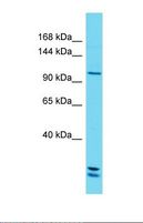 MICAL2 Antibody - Western blot of Human Jurkat. MICAL2 antibody dilution 1.0 ug/ml.  This image was taken for the unconjugated form of this product. Other forms have not been tested.