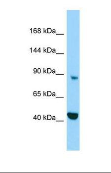 MICAL2 Antibody - Western blot of Human HepG2. MICAL2 antibody dilution 1.0 ug/ml.  This image was taken for the unconjugated form of this product. Other forms have not been tested.