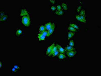 MICAL2 Antibody - Immunofluorescent analysis of HepG2 cells using MICAL2 Antibody at dilution of 1:100 and Alexa Fluor 488-congugated AffiniPure Goat Anti-Rabbit IgG(H+L)