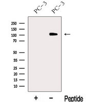 MICAL2 Antibody - Western blot analysis of extracts of PC-3 cells using MICAL2 antibody. The lane on the left was treated with blocking peptide.