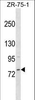 MICALCL Antibody - MICALCL Antibody western blot of ZR-75-1 cell line lysates (35 ug/lane). The MICALCL antibody detected the MICALCL protein (arrow).