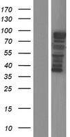 MICALCL Protein - Western validation with an anti-DDK antibody * L: Control HEK293 lysate R: Over-expression lysate