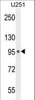 MICALL1 / MICAL-L1 Antibody - MICALL1 Antibody western blot of U251 cell line lysates (35 ug/lane). The MICALL1 antibody detected the LACRT protein (arrow).