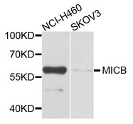MICB Antibody - Western blot analysis of extracts of various cells.