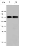 MICB Antibody - Anti-MICB rabbit polyclonal antibody at 1:500 dilution. Lane A: Jurkat Whole Cell Lysate. Lane B: MCF7 Whole Cell Lysate. Lysates/proteins at 30 ug per lane. Secondary: Goat Anti-Rabbit IgG (H+L)/HRP at 1/10000 dilution. Developed using the ECL technique. Performed under reducing conditions. Predicted band size: 40 kDa. Observed band size: 55 kDa.