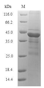Acylhomoserine lactonase (aiiM) Protein - (Tris-Glycine gel) Discontinuous SDS-PAGE (reduced) with 5% enrichment gel and 15% separation gel.