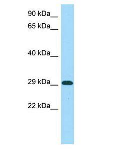 MICU1 / CBARA1 Antibody - MICU1 / CBARA1 antibody Western Blot of MCF7. Antibody dilution: 1 ug/ml.  This image was taken for the unconjugated form of this product. Other forms have not been tested.