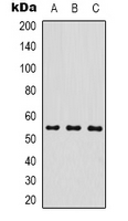 MICU1 / CBARA1 Antibody - Western blot analysis of MICU1 expression in MCF7 (A); mouse brain (B); rat brain (C) whole cell lysates.