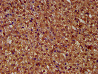 MICU1 / CBARA1 Antibody - Immunohistochemistry image at a dilution of 1:400 and staining in paraffin-embedded human adrenal gland tissue performed on a Leica BondTM system. After dewaxing and hydration, antigen retrieval was mediated by high pressure in a citrate buffer (pH 6.0) . Section was blocked with 10% normal goat serum 30min at RT. Then primary antibody (1% BSA) was incubated at 4 °C overnight. The primary is detected by a biotinylated secondary antibody and visualized using an HRP conjugated SP system.