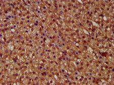 MICU1 / CBARA1 Antibody - Immunohistochemistry image at a dilution of 1:400 and staining in paraffin-embedded human adrenal gland tissue performed on a Leica BondTM system. After dewaxing and hydration, antigen retrieval was mediated by high pressure in a citrate buffer (pH 6.0) . Section was blocked with 10% normal goat serum 30min at RT. Then primary antibody (1% BSA) was incubated at 4 °C overnight. The primary is detected by a biotinylated secondary antibody and visualized using an HRP conjugated SP system.