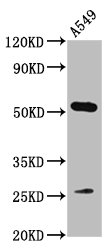 MICU1 / CBARA1 Antibody - Positive Western Blot detected in A549 whole cell lysate. All lanes: MICU1 antibody at 3.2 µg/ml Secondary Goat polyclonal to rabbit IgG at 1/50000 dilution. Predicted band size: 55, 46, 33, 32 KDa. Observed band size: 55 KDa