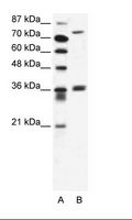 MID1 Antibody - A: Marker, B: Jurkat Cell Lysate.  This image was taken for the unconjugated form of this product. Other forms have not been tested.