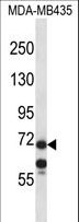 MID1 Antibody - MID1 Antibody western blot of MDA-MB435 cell line lysates (35 ug/lane). The MID1 antibody detected the MID1 protein (arrow).
