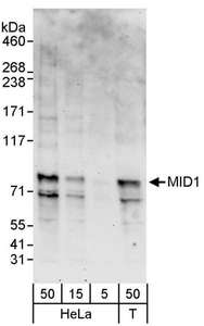MID1 Antibody - Detection of Human MID1 by Western Blot. Samples: Whole cell lysate from HeLa (5, 15 and 50 ug) and 293T (T; 50 ug) cells. Antibodies: Affinity purified rabbit anti-MID1 antibody used for WB at 1 ug/ml. Detection: Chemiluminescence with an exposure time of 3 minutes.