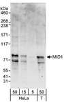 MID1 Antibody - Detection of Human MID1 by Western Blot. Samples: Whole cell lysate from HeLa (5, 15 and 50 ug) and 293T (T; 50 ug) cells. Antibodies: Affinity purified rabbit anti-MID1 antibody used for WB at 1 ug/ml. Detection: Chemiluminescence with an exposure time of 3 minutes.
