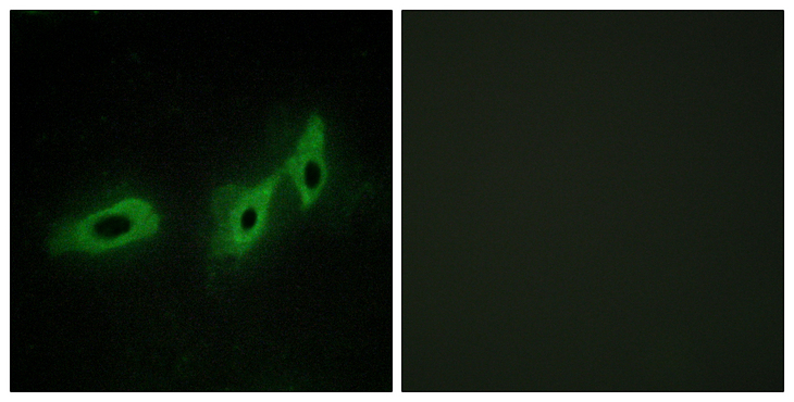 MID1 Antibody - Immunofluorescence analysis of HeLa cells, using TRI18 Antibody. The picture on the right is blocked with the synthesized peptide.