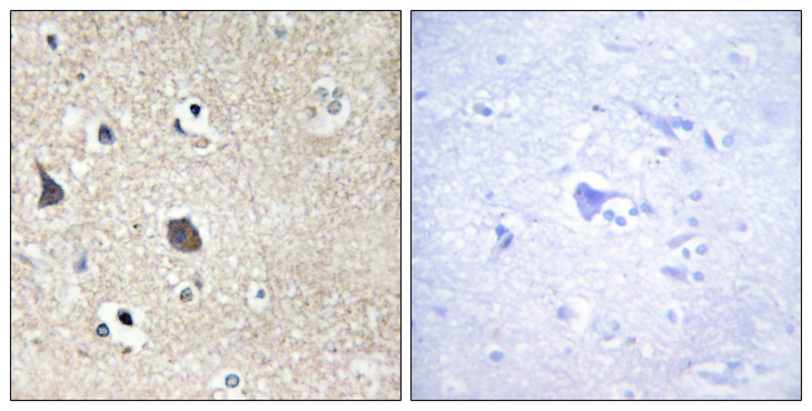 MID1 Antibody - Immunohistochemistry analysis of paraffin-embedded human brain tissue, using TRI18 Antibody. The picture on the right is blocked with the synthesized peptide.