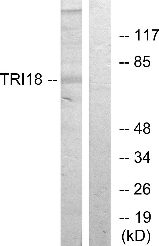 MID1 Antibody - Western blot analysis of lysates from 293 cells, using TRI18 Antibody. The lane on the right is blocked with the synthesized peptide.