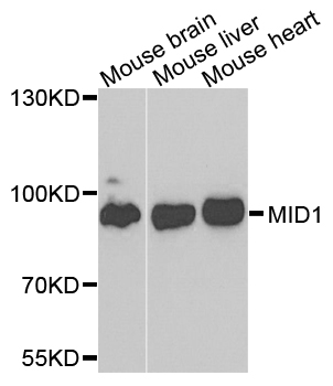 MID1 Antibody - Western blot analysis of extracts of various cells.