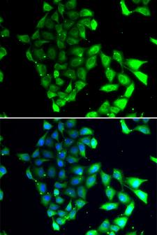 MID1 Antibody - Immunofluorescence analysis of MCF7 cells.