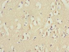 MID1 Antibody - Immunohistochemistry of paraffin-embedded human brain tissue at dilution 1:100