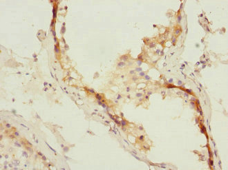 MID1 Antibody - Immunohistochemistry of paraffin-embedded human testis tissue at dilution 1:100