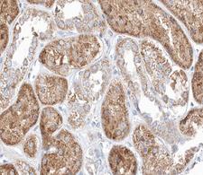 MID1 Antibody - 1:100 staining human kidney tissue by IHC-P. The tissue was formaldehyde fixed and a heat mediated antigen retrieval step in citrate buffer was performed. The tissue was then blocked and incubated with the antibody for 1.5 hours at 22°C. An HRP conjugated goat anti-rabbit antibody was used as the secondary.