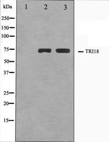 MID1 Antibody - Western blot analysis on A549 and HuvEc cell lysates using TRI18 antibody. The lane on the left is treated with the antigen-specific peptide.