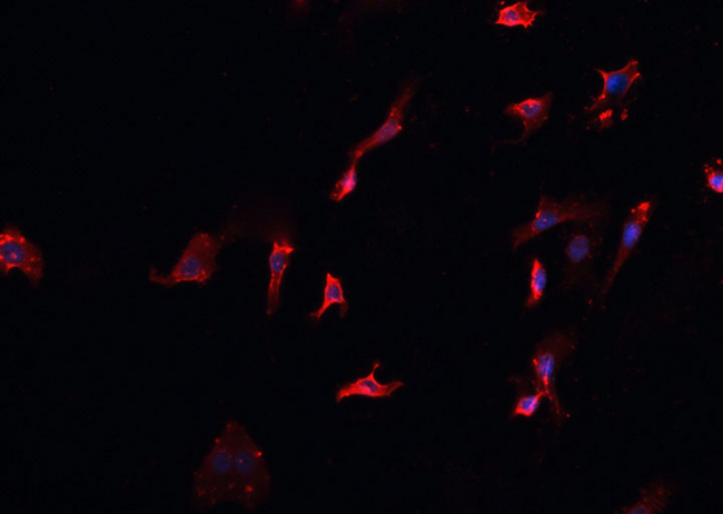 MID1 Antibody - Staining HeLa cells by IF/ICC. The samples were fixed with PFA and permeabilized in 0.1% Triton X-100, then blocked in 10% serum for 45 min at 25°C. The primary antibody was diluted at 1:200 and incubated with the sample for 1 hour at 37°C. An Alexa Fluor 594 conjugated goat anti-rabbit IgG (H+L) antibody, diluted at 1/600, was used as secondary antibody.
