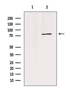MID1 Antibody - Western blot analysis of extracts of HepG2 cells using TRI18 antibody. Lane 1 was treated with the blocking peptide.
