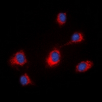 MID1 Antibody - Immunofluorescent analysis of MID1 staining in HeLa cells. Formalin-fixed cells were permeabilized with 0.1% Triton X-100 in TBS for 5-10 minutes and blocked with 3% BSA-PBS for 30 minutes at room temperature. Cells were probed with the primary antibody in 3% BSA-PBS and incubated overnight at 4 deg C in a humidified chamber. Cells were washed with PBST and incubated with a DyLight 594-conjugated secondary antibody (red) in PBS at room temperature in the dark. DAPI was used to stain the cell nuclei (blue).