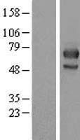 MID1 Protein - Western validation with an anti-DDK antibody * L: Control HEK293 lysate R: Over-expression lysate