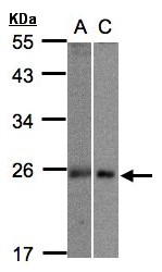 MID1IP1 Antibody - Sample (30 ug whole cell lysate). A:293T, B: Hep G2 . 12% SDS PAGE. MID1IP1 antibody diluted at 1:1000