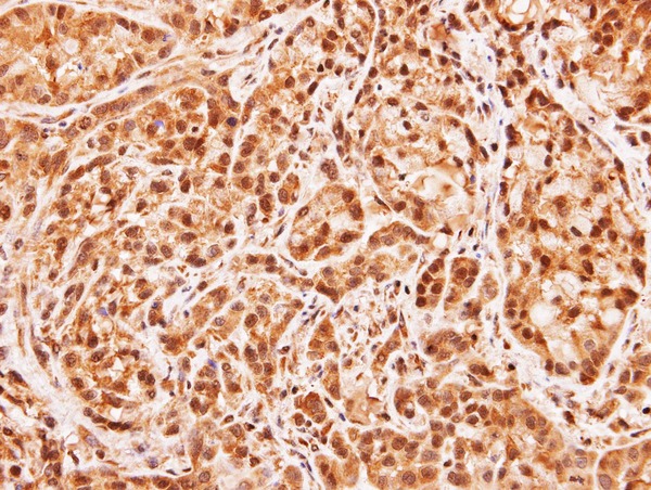 MID1IP1 Antibody - IHC of paraffin-embedded A549 xenograft using MID1IP1 antibody at 1:100 dilution.