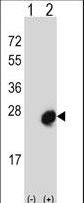 MID1IP1 Antibody - Western blot of MID1IP1 (arrow) using rabbit polyclonal MID1IP1 Antibody. 293 cell lysates (2 ug/lane) either nontransfected (Lane 1) or transiently transfected (Lane 2) with the MID1IP1 gene.