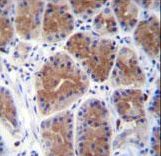 MID1IP1 Antibody - MID1IP1 Antibody immunohistochemistry of formalin-fixed and paraffin-embedded human stomach tissue followed by peroxidase-conjugated secondary antibody and DAB staining.