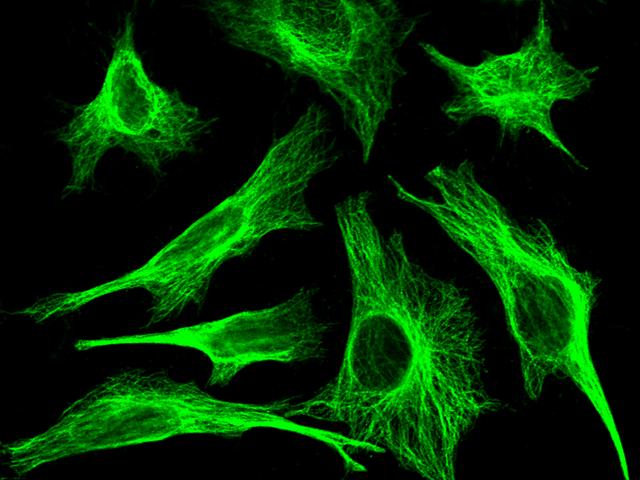 MID1IP1 Antibody - Immunofluorescence staining of MID1IP1 in Hela cells. Cells were fixed with 4% PFA, permeabilzed with 0.1% Triton X-100 in PBS, blocked with 10% serum, and incubated with rabbit anti-human MID1IP1 monoclonal antibody (dilution ratio 1:60) at 4°C overnight. Then cells were stained with the Alexa Fluor 488-conjugated Goat Anti-rabbit IgG secondary antibody (green). Positive staining was localized to Cytoskeleton.