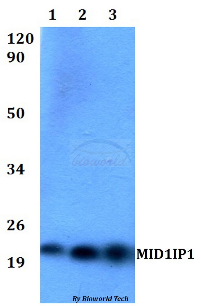 MID1IP1 Antibody - Western blot of MID1IP1 antibody at 1:500 dilution. Lane 1: HEK293Twhole cell lysate. Lane 2: Raw264.7 whole cell lysate. Lane 3: PC12 whole cell lysate.
