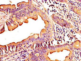 MID1IP1 Antibody - Immunohistochemistry image at a dilution of 1:300 and staining in paraffin-embedded human small intestine tissue performed on a Leica BondTM system. After dewaxing and hydration, antigen retrieval was mediated by high pressure in a citrate buffer (pH 6.0) . Section was blocked with 10% normal goat serum 30min at RT. Then primary antibody (1% BSA) was incubated at 4 °C overnight. The primary is detected by a biotinylated secondary antibody and visualized using an HRP conjugated SP system.