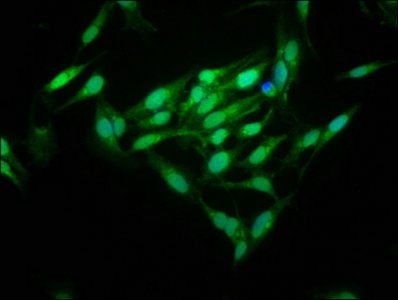 MID1IP1 Antibody - Immunofluorescence staining of Hela cells with MID1IP1 Antibody at 1:125, counter-stained with DAPI. The cells were fixed in 4% formaldehyde, permeabilized using 0.2% Triton X-100 and blocked in 10% normal Goat Serum. The cells were then incubated with the antibody overnight at 4°C. The secondary antibody was Alexa Fluor 488-congugated AffiniPure Goat Anti-Rabbit IgG(H+L).