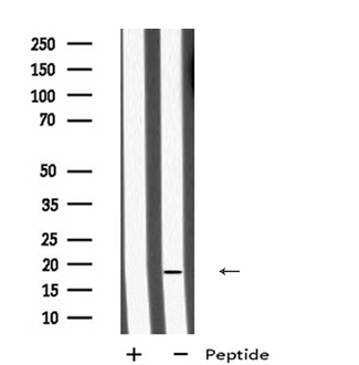 MID1IP1 Antibody - Western blot analysis of MID1IP1 using HepG2 whole cells lysates