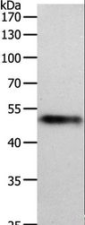 MIDN Antibody - Western blot analysis of Human lung tissue, using MIDN Polyclonal Antibody at dilution of 1:1000.
