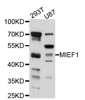 MIEF1 / SMCR7L Antibody - Western blot analysis of extracts of various cell lines, using MIEF1 antibody at 1:1000 dilution. The secondary antibody used was an HRP Goat Anti-Rabbit IgG (H+L) at 1:10000 dilution. Lysates were loaded 25ug per lane and 3% nonfat dry milk in TBST was used for blocking. An ECL Kit was used for detection and the exposure time was 30s.