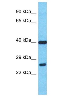 MIEF2 / SMCR7 Antibody - MIEF2 / SMCR7 antibody Western Blot of MCF7. Antibody dilution: 1 ug/ml.  This image was taken for the unconjugated form of this product. Other forms have not been tested.