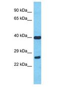 MIEF2 / SMCR7 Antibody - MIEF2 / SMCR7 antibody Western Blot of MCF7. Antibody dilution: 1 ug/ml.  This image was taken for the unconjugated form of this product. Other forms have not been tested.