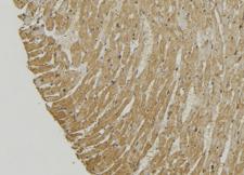 MIEF2 / SMCR7 Antibody - 1:100 staining mouse muscle tissue by IHC-P. The sample was formaldehyde fixed and a heat mediated antigen retrieval step in citrate buffer was performed. The sample was then blocked and incubated with the antibody for 1.5 hours at 22°C. An HRP conjugated goat anti-rabbit antibody was used as the secondary.