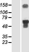 MIEF2 / SMCR7 Protein - Western validation with an anti-DDK antibody * L: Control HEK293 lysate R: Over-expression lysate